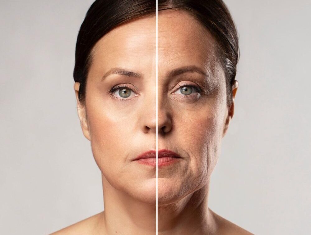 Ráncok, öregedő bőr